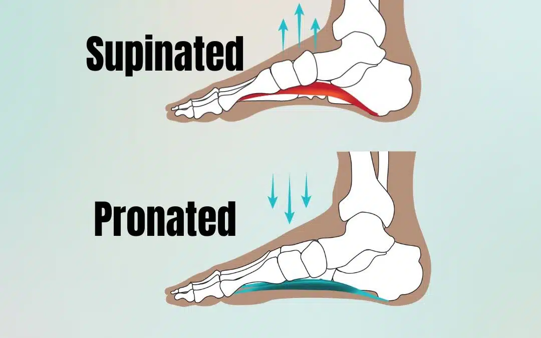 What is pronation and what should you do about it?