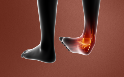 Why do you keep rolling or spraining your ankles?