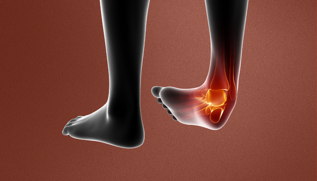 Why do you keep rolling or spraining your ankles?